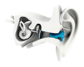 3D Ear Render